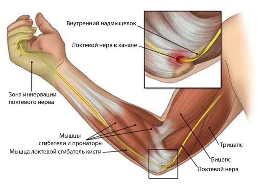 Почему дергается нерв на руке? Почему дергается нерв на руке?